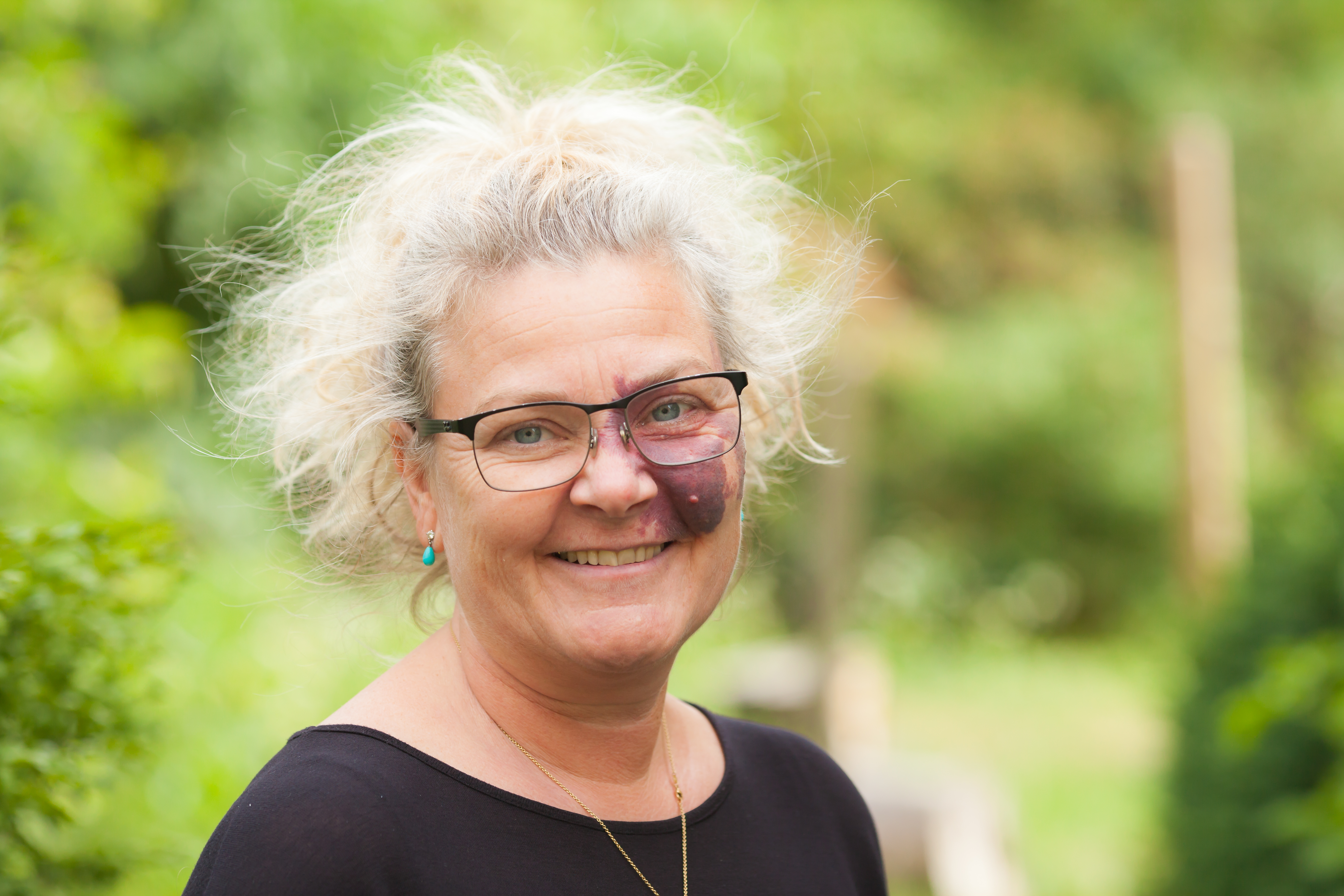 Anne Birgitte Dahl